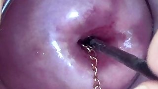 Extreme Asian Cervix Playing with Injection..